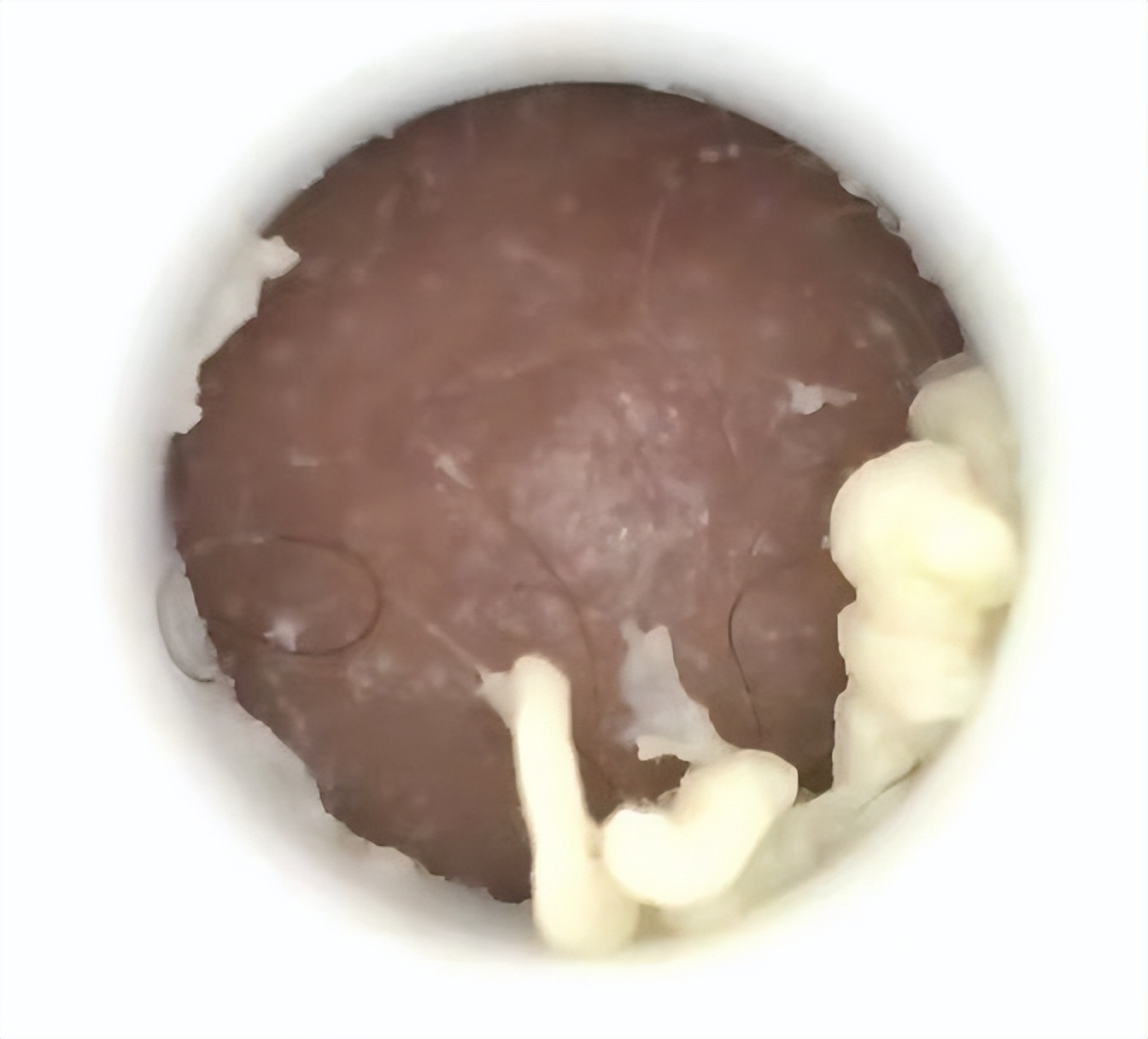 美容院护肤去黑头正常价格,小气泡去黑头美容仪器