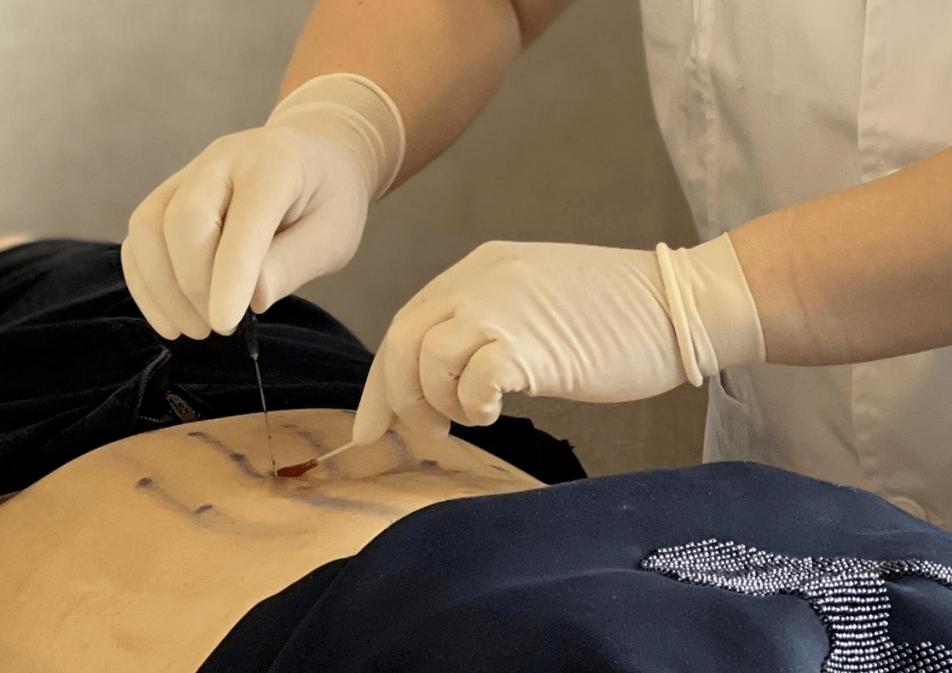 如何治愈单纯性肥胖脾虚,儿童肥胖脾虚湿盛怎么调养