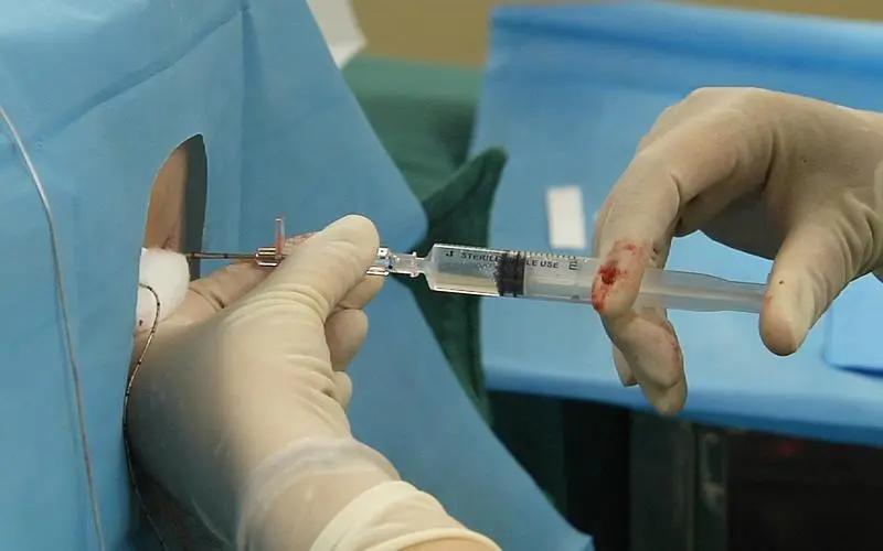 全身麻醉到死亡有知觉吗,全身麻醉就像死过一次