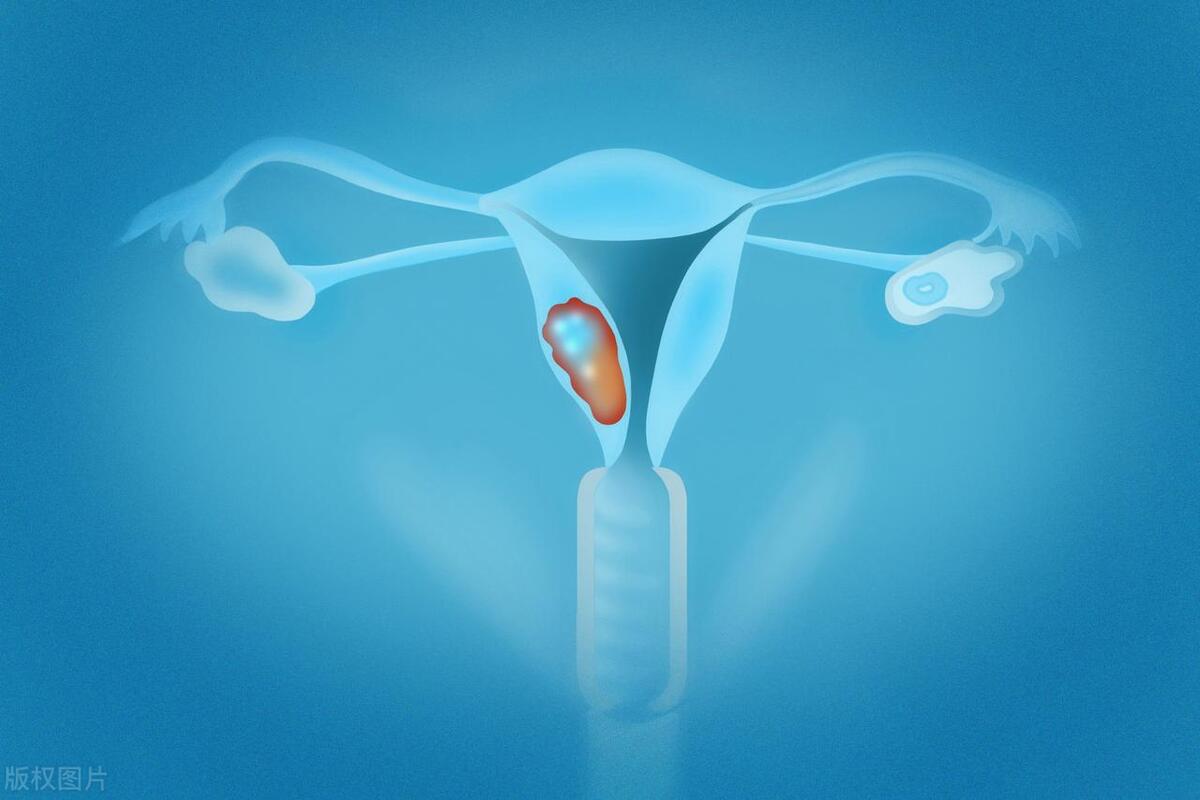 我安享晚年的年纪，却闻到自己身上有腥臭味，还伴有排液、瘙痒