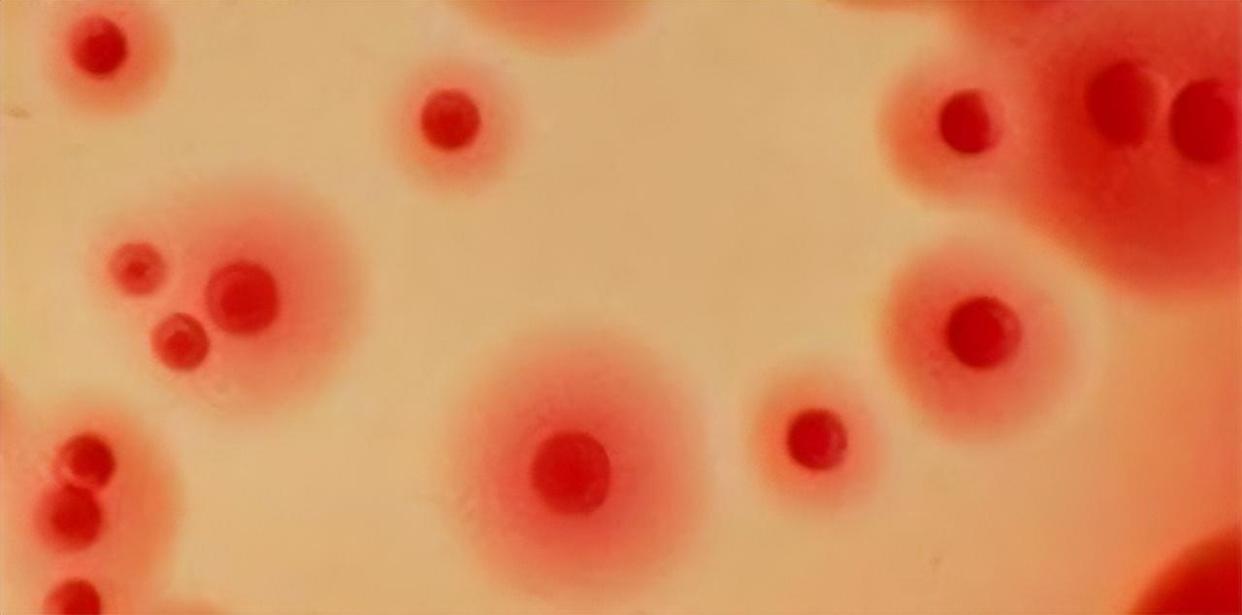 梅毒潜伏性,梅毒能在身体里潜伏几年没有症状