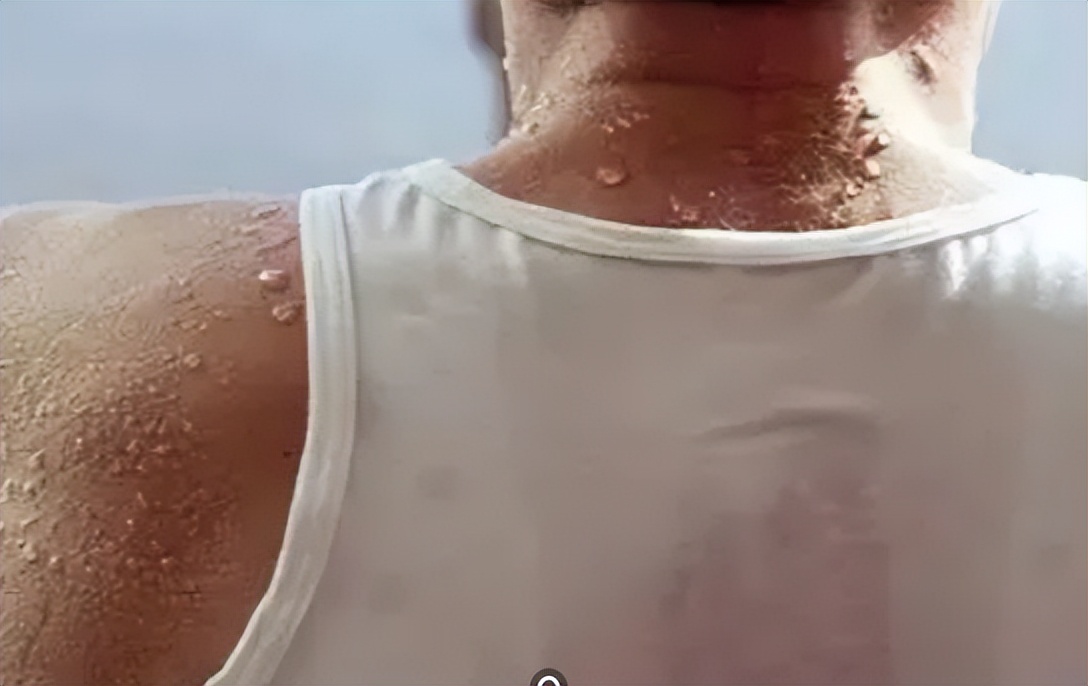 蚊子用什么药防蚊,蚊子防蚊指南图解