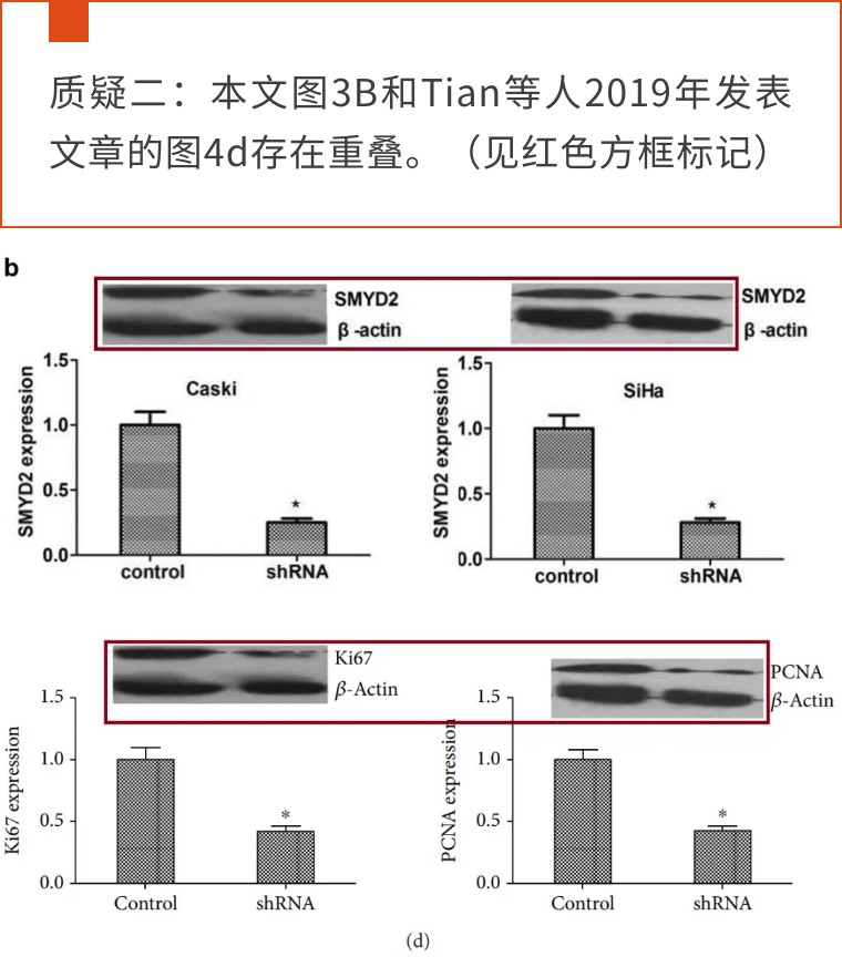 天津医科大学第二医院的9分论文遭评议！疑似与同期论文多图重叠
