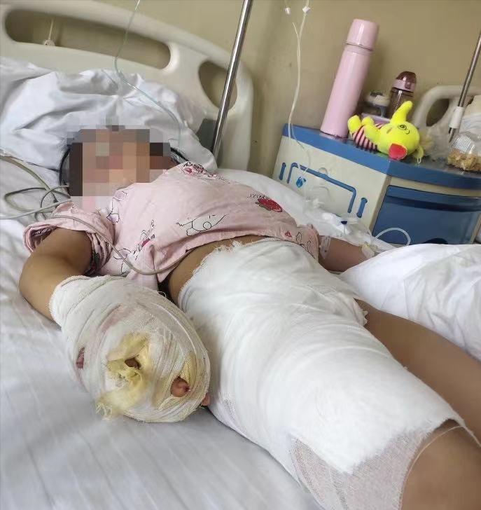 六岁女童惨遭后妈虐待,六岁女童遭后妈虐待后续报道