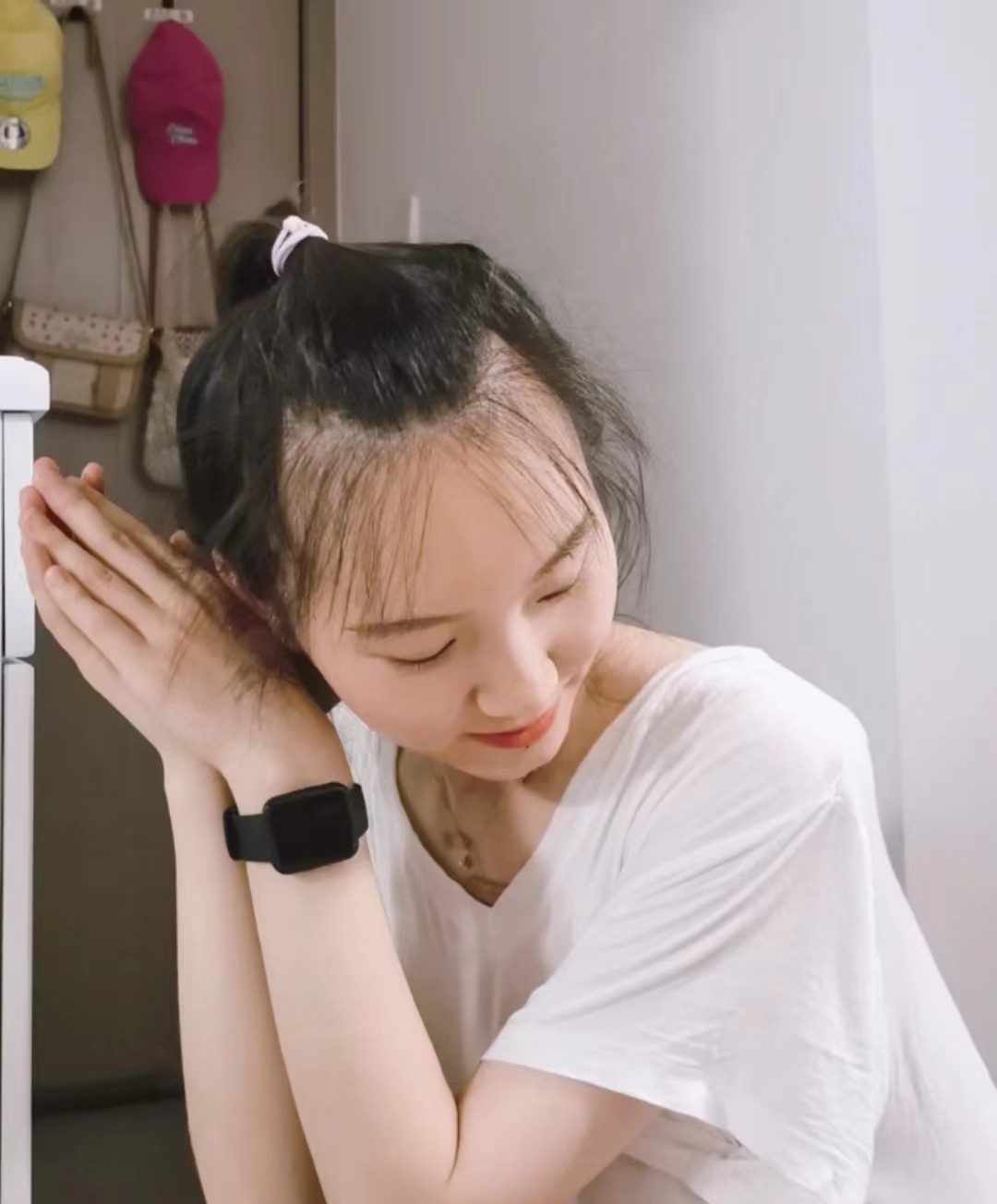 发际线对颜值的重要性,发际线对颜值的影响