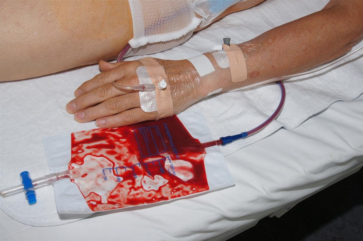 艾滋病的防治策略答案,艾滋病的元凶