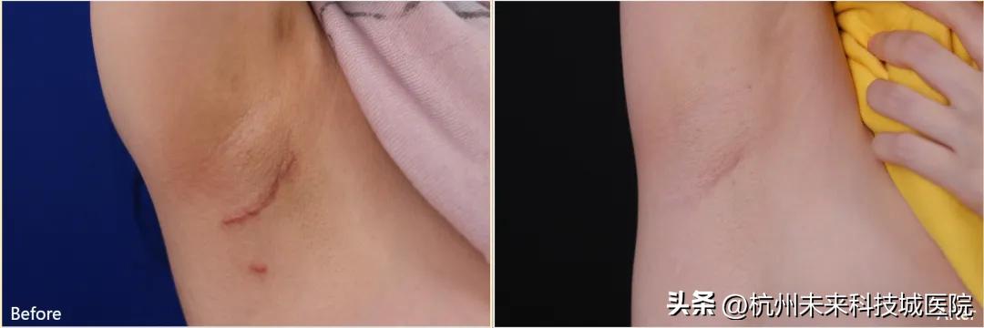 不追求一个模板的复制美|17年专注年轻化专家