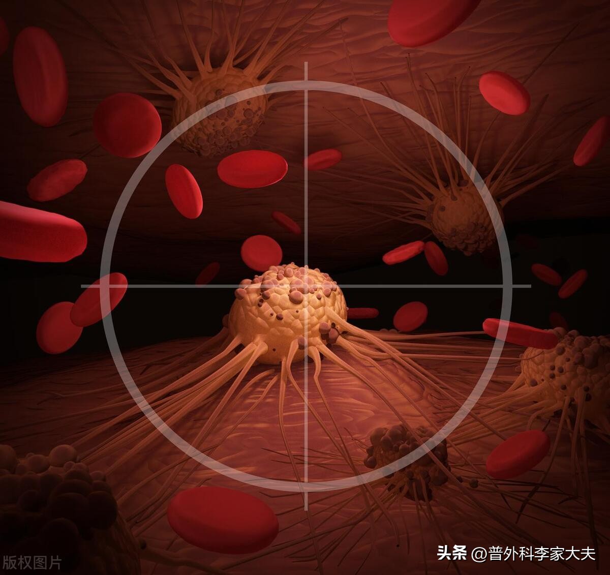 肝癌靶向治疗是怎么治疗,肝癌靶向药物治疗能达到什么效果
