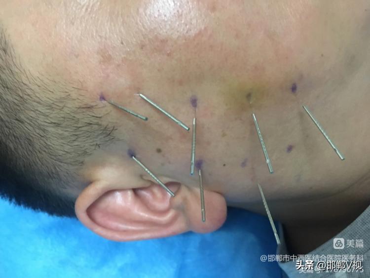 邯郸市中西医结合医院有哪些,邯郸市第一医院中西医结合科门诊