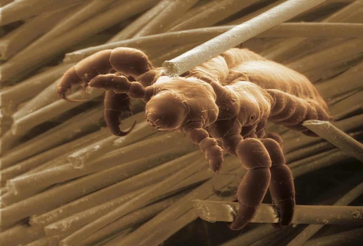 虱子在头上有什么危害,虱子对人体有哪些害处