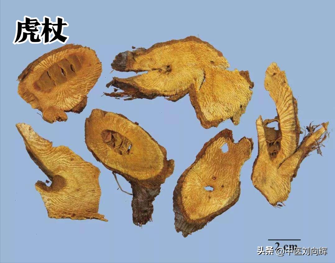 脂肪肝用哪种疏肝健脾药,脂肪肝配合什么药物