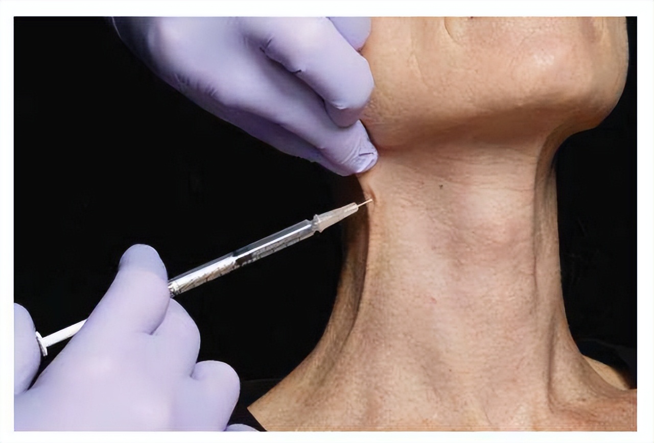 颈纹特别深的年轻女人,颈纹很显老手把手教你小妙招