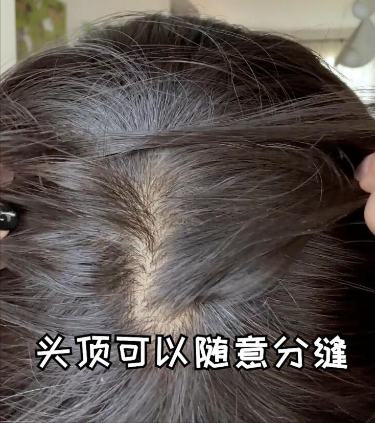 头顶假发3款最后一款最自然,推荐哪种款的假发好看又好戴