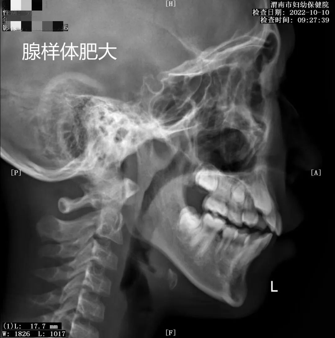 致敬公司的摄影师,美女致敬摄影师视频