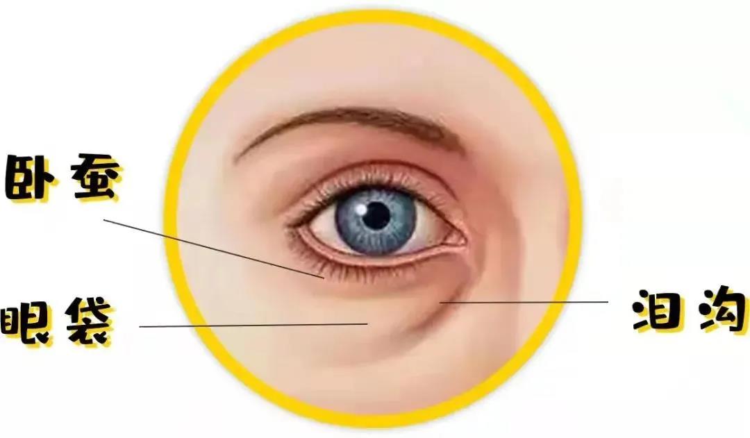 卧蚕黑眼圈傻傻分不清,眼袋卧蚕泪沟黑眼圈哪个最显老
