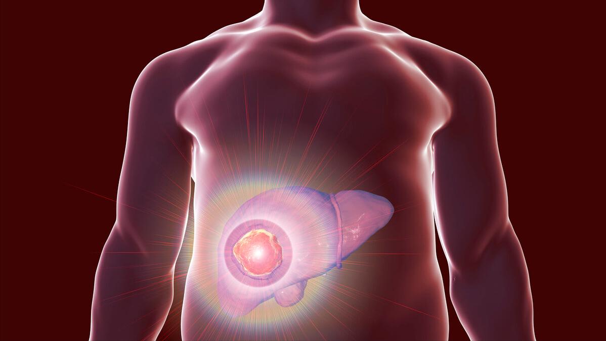 胆囊肿瘤的前兆,胆囊发生前期病变