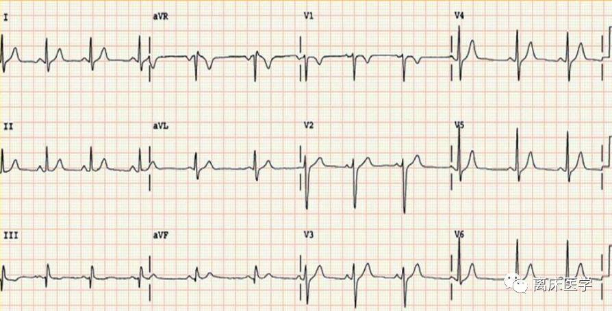 血钾危急,高钾血症危急值记录