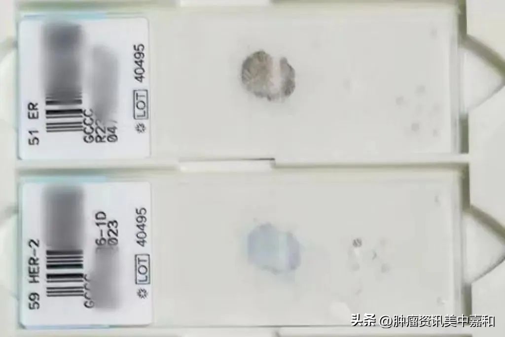 he切片和白片的区别,病理切片和白片的区别