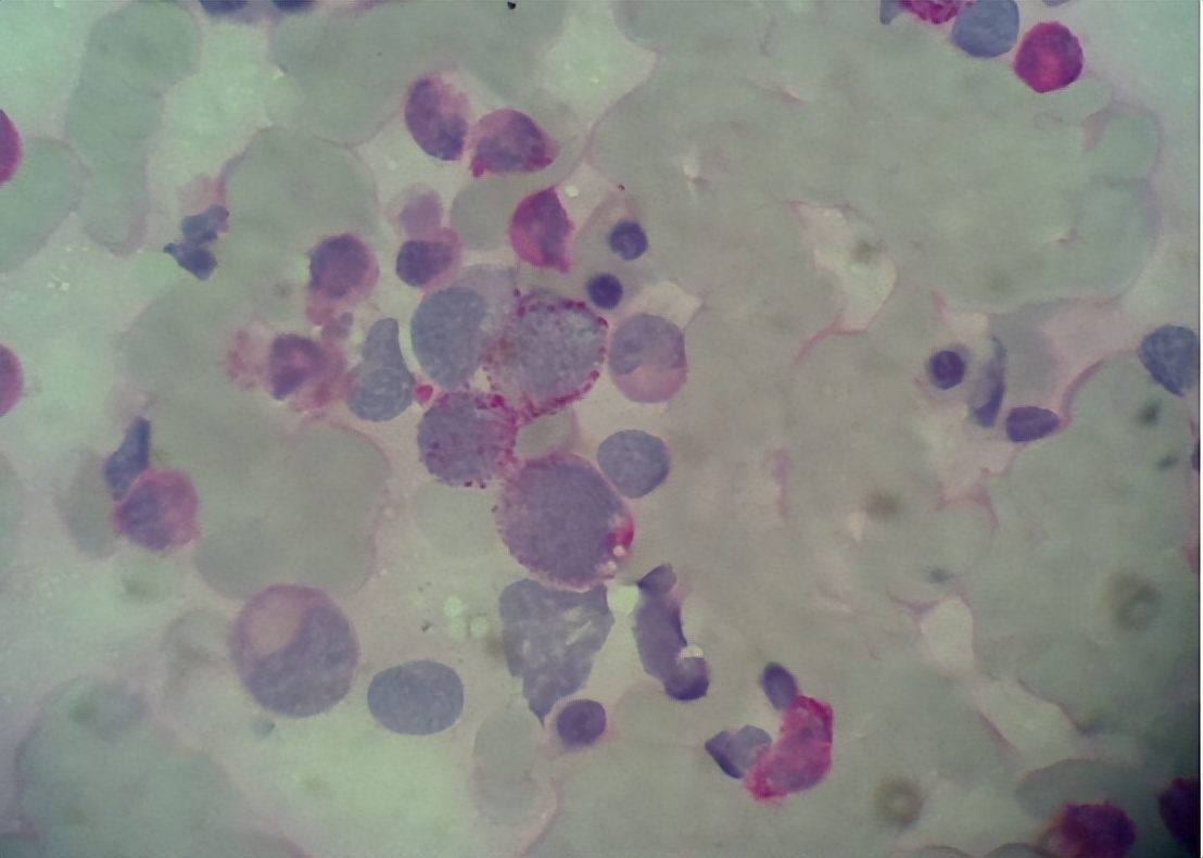 食品中铝残留和含铝添加剂有关吗,铝食品添加剂的危害