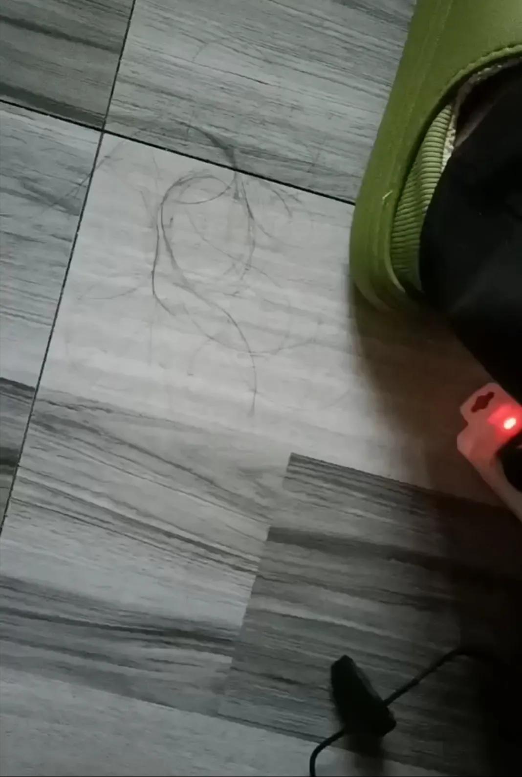 脱发掉头发怎么解决,治疗脱发断发的方法