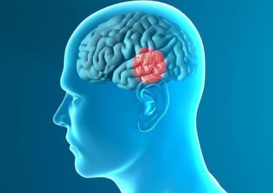 止咳神药甘草片为什么限购,为什么复方甘草片止咳效果那么好