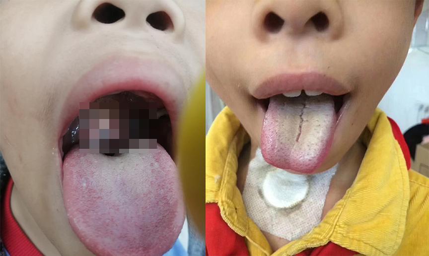 7个常见原因，造成孩子长得又矮又慢，附对应解决办法，家长悉知