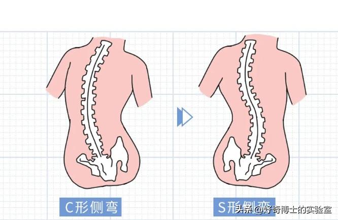 哪些姿势会把腰弄坏,什么姿势容易损伤腰