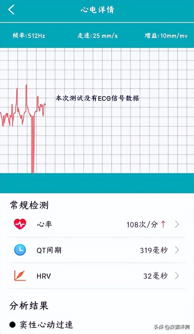 didoy2s智能血压手环测评,didog28s心电血糖智能手表测评