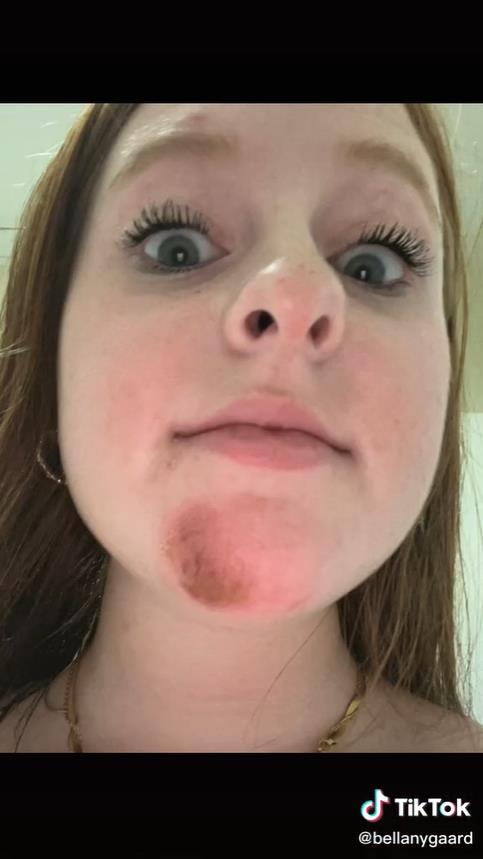 澳洲妹子和男友接吻,澳大利亚女子与男友接吻