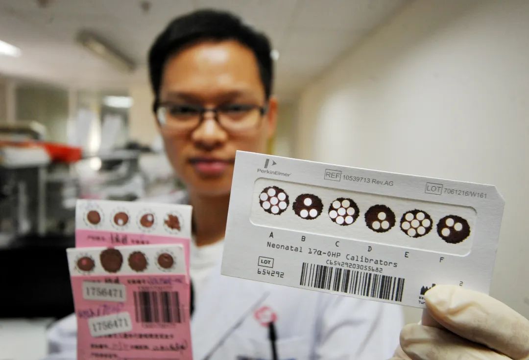 刚出生的婴儿会有遗传病吗,刚出生不久的小孩血液有致聋基因