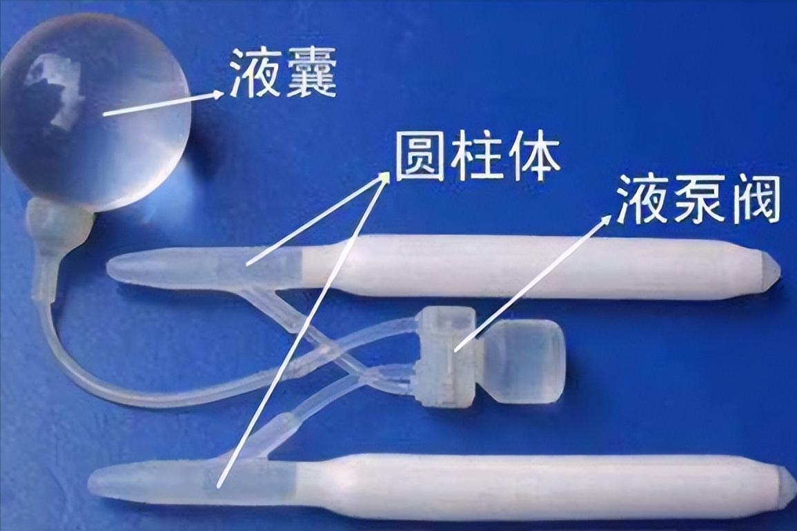 现有带马达的人造“丁丁”，今后男人不会再有“男题”