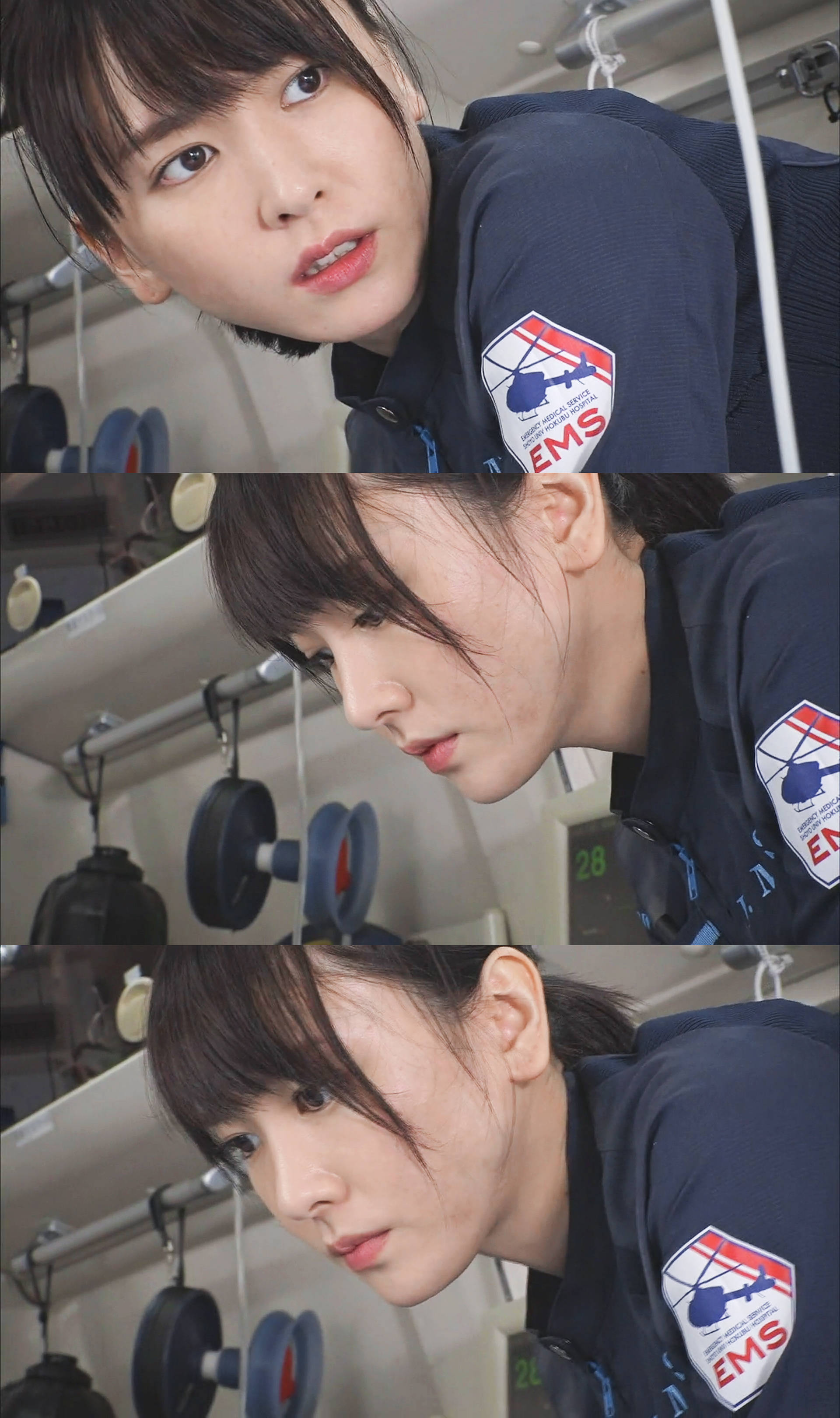 戴牙套导致的脸颊凹陷能不能恢复,戴了牙套导致太阳穴凹陷和颧骨凸