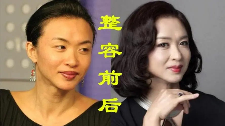 男子做手术变成了女儿身,越南男子24岁做手术变成女子