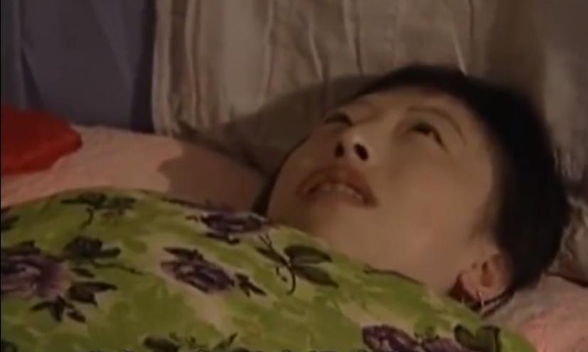 故事：大连39岁姑娘患怪病，皮肤坚硬宛如石膏，专家结论希望渺茫