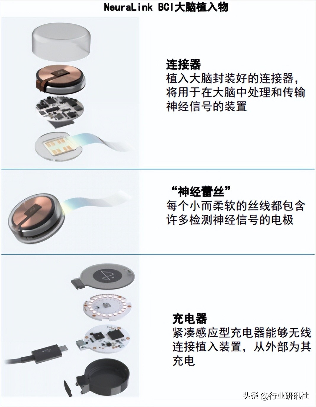 脑机接口发展现状及展望,脑机接口公司靠什么盈利