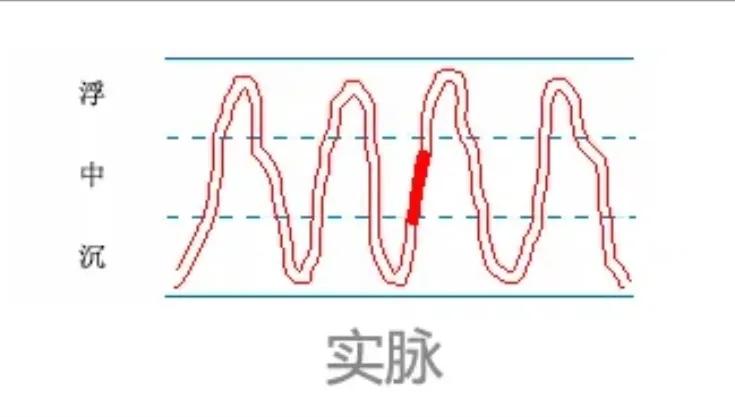 中医28脉诊歌诀及示意图,中医28脉全部脉象图解