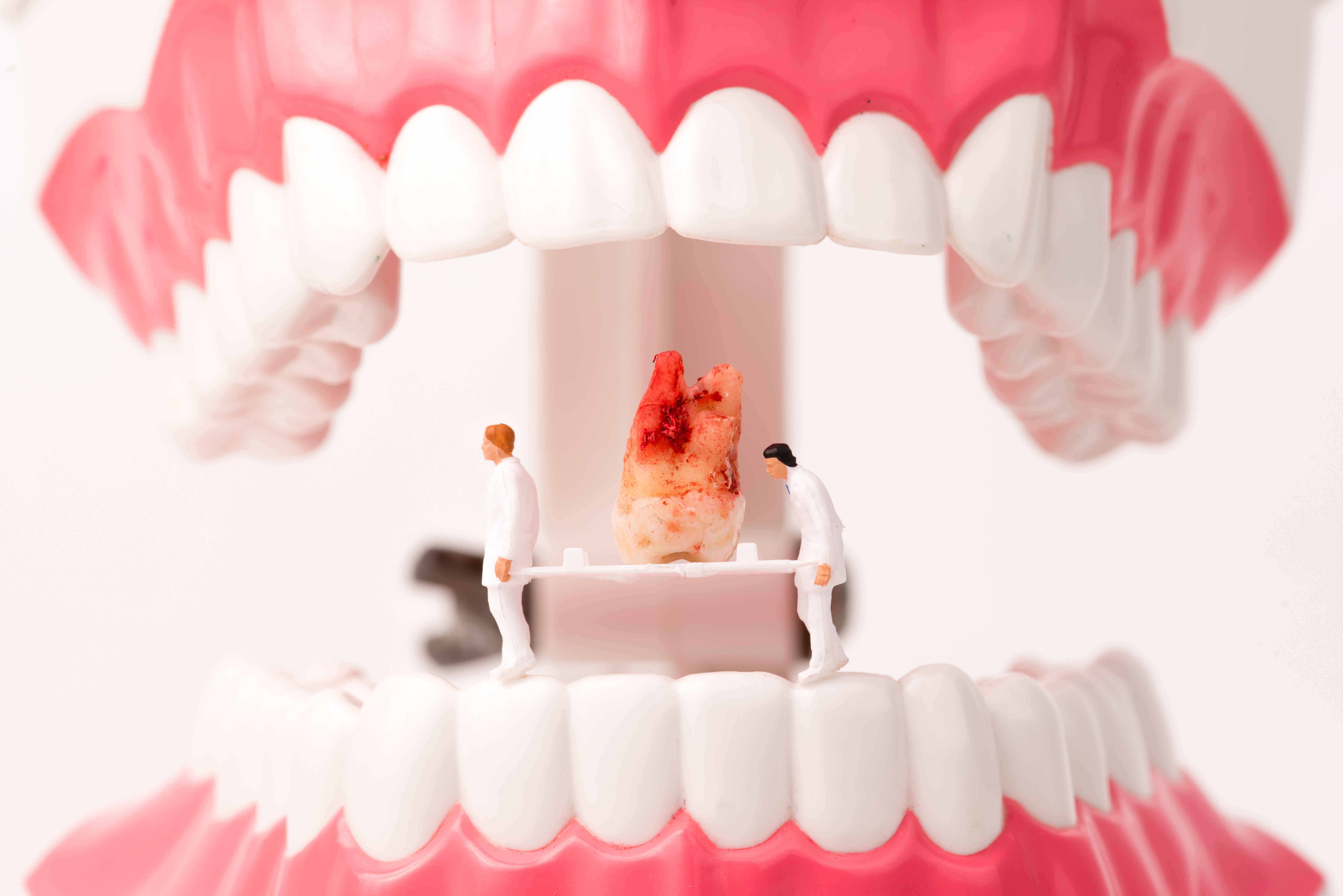 人到中年牙齿松了怎么办,成年人牙齿松动多久能长好