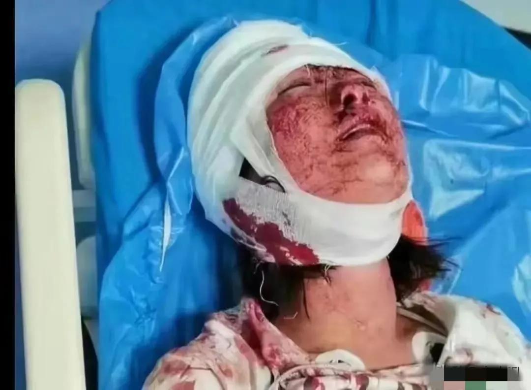 唐山打人事件：从“东北二王”看陈继志为何一步步走向万丈深渊？