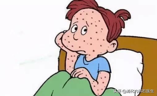 女人右下腹阑尾部位疼痛什么原因,女性右下腹疼伴有恶心阑尾已切除