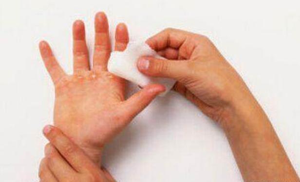 孩子被开水烫伤了该如何紧急处理,小孩被热水烫伤了该怎么处理