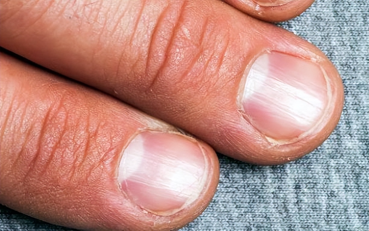 体内有癌皮肤先知提醒,体内有癌手部先知有三种表现