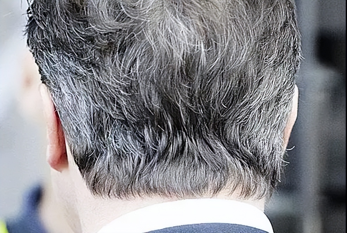 白头发变黑发需要怎么补充营养素,白头发要补什么营养素最好