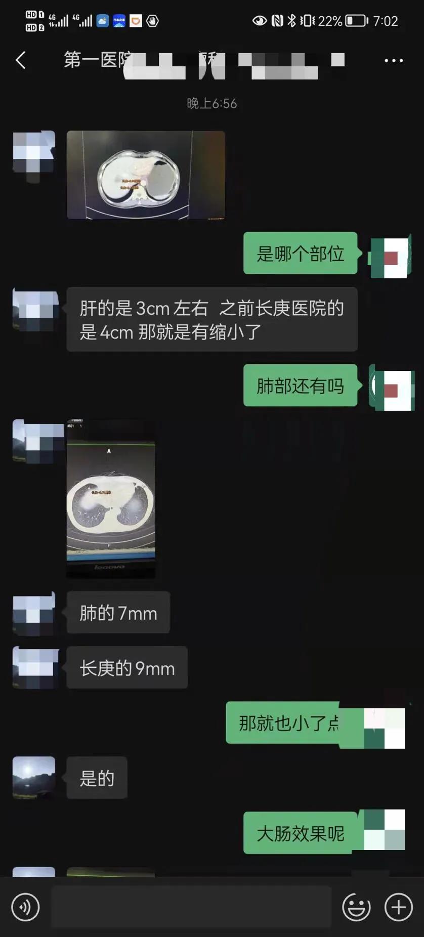 乙状肠癌晚期没扩散能活多久,八十多岁肠癌晚期扩散到肺部