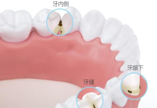 电动牙刷有哪些好的牌子推荐知乎,电动牙刷选什么品牌的最好
