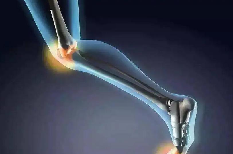 关节疼痛快速解决最好办法,关节疼痛怎么办最简单方法