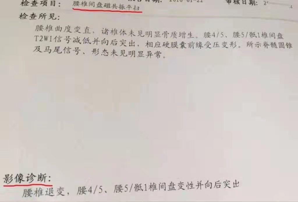 在家如何拍ct片子,在家可以拍ct