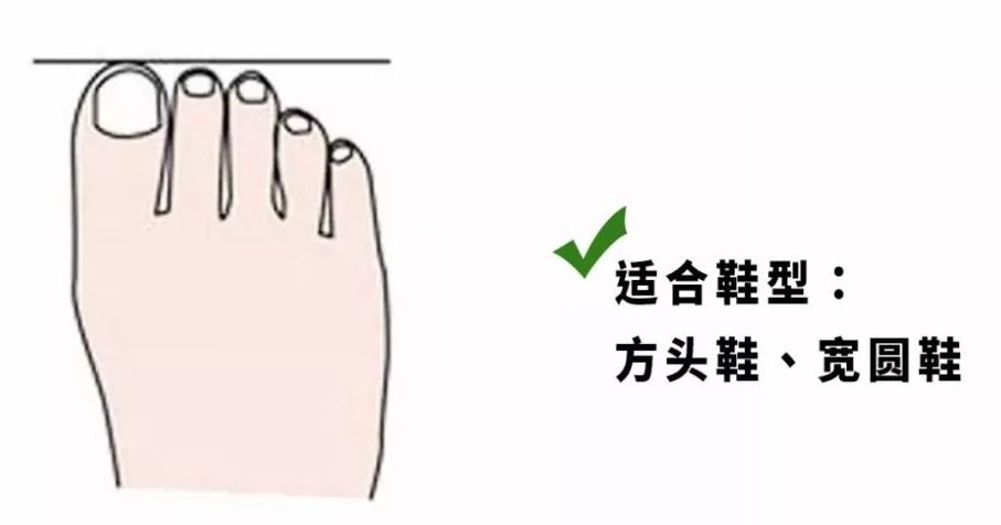 鞋子太紧穿不舒服怎么办,鞋子太松不跟脚