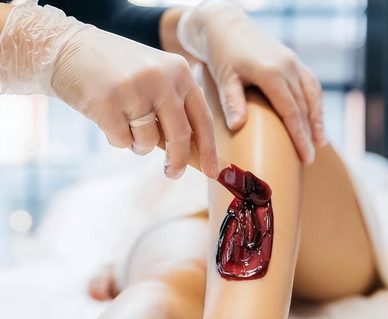 脱毛全攻略｜夏日不脱毛，人间猕猴桃