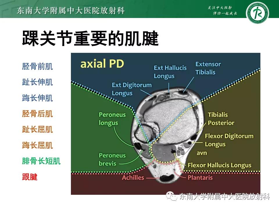 好文分享-《肌骨系统疾病——副舟骨综合征》