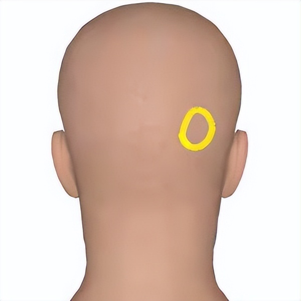 偏头痛犯了怎么安慰,如何对付偏头痛